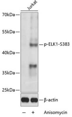 Western Blot: Elk-1 [p Ser383] AntibodyBSA Free [NBP3-05380]